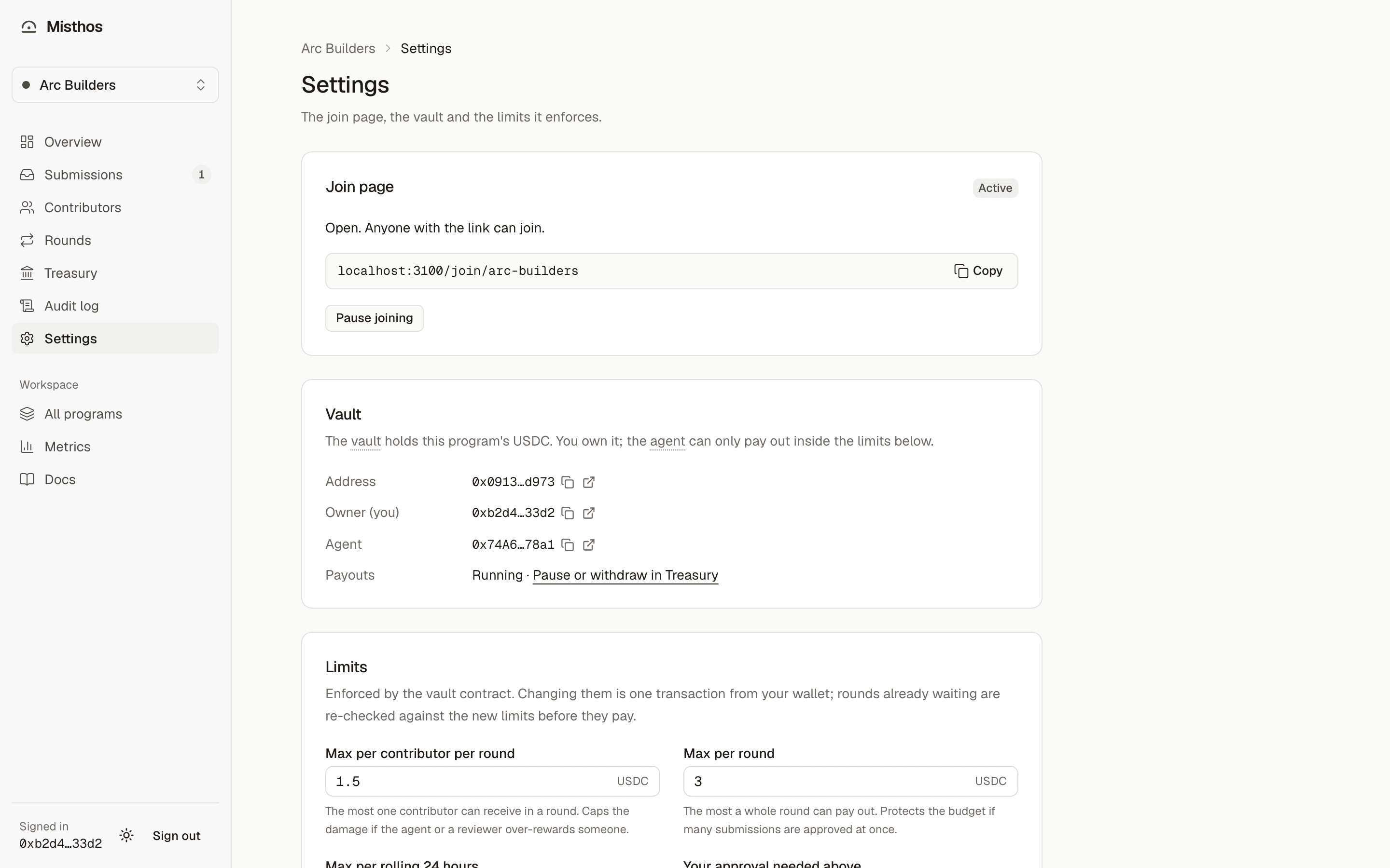Vault settings with deploy, deposit and limits
